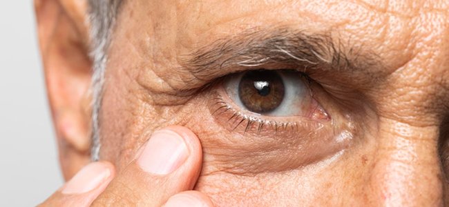 Common Eye Diseases And Vision Problems